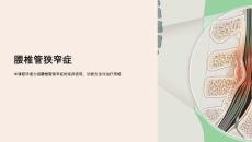 《腰椎管狭窄症》课件