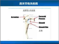 肩部疼痛疾病治疗与预防攻略培训课件