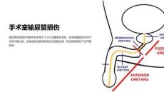 《手术室输尿管损伤》课件