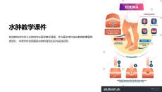水肿教学课件