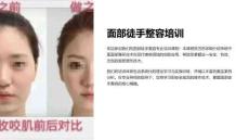 面部徒手整容培訓(xùn)課件
