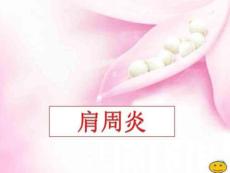 肩周炎课件