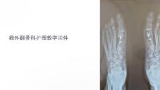 拇外翻骨科护理教学课件