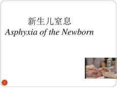 新生儿窒息