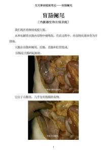 0515-艾氏解剖筆記：盲腸闌尾