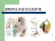 ERCP及術前術后護理內容培訓ppt