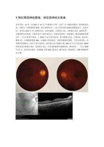 1例右眼視神經(jīng)萎縮、球后視神經(jīng)炎患者