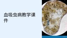血吸虫病教学课件