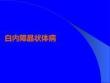 白內(nèi)障晶狀體病PPT課件