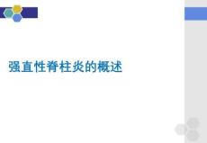 強直性脊柱炎的概述PPT課件