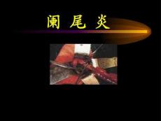 阑尾炎课件