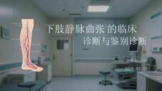 下肢靜脈曲張的臨床診斷與鑒別診斷