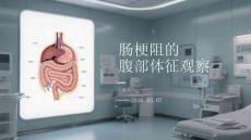 腸梗阻的腹部體征觀察