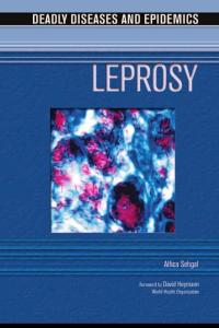 美國中學科學讀物-疾病與流行病-麻風病 Deadly Diseases and Epidemics - Leprosy