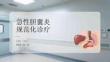 急性膽囊炎規(guī)范化診療