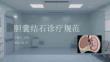膽囊結(jié)石診療規(guī)范