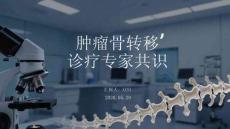 腫瘤骨轉移診療專家共識