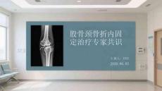 股骨頸骨折內固定治療專家共識