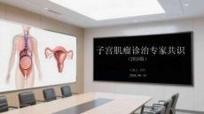 子宫肌瘤诊治专家共识（2025版）