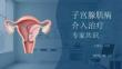 子宮腺肌病介入治療專家共識