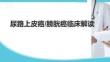 尿路上皮癌膀胱癌臨床解讀