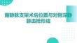 髂靜脈支架術后位置與對側深靜脈血栓形成