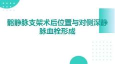 髂靜脈支架術(shù)后位置與對側(cè)深靜脈血栓形成