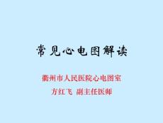 解读常见心电图