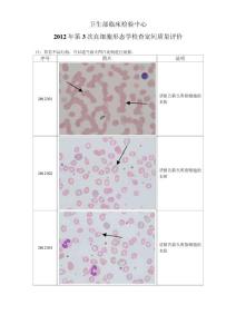 2012年第3次血细胞形态学检查室间质量评价
