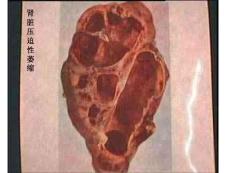 病理图片库