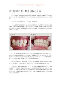 常州美容冠能不能快速矯正牙齒