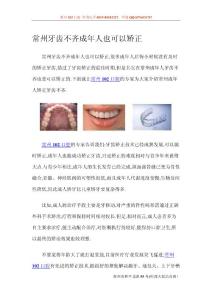 常州牙齒不齊成年人也可以矯正