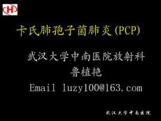 卡氏肺孢子菌肺炎