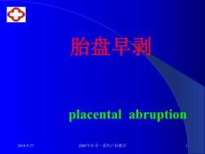 妇产 胎盘早剥