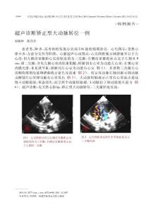 超声诊断矫正型大动脉转位一例