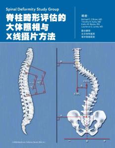 脊柱畸形评估的大体照相与X线摄片方法 - 北京协和医院