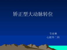 矫正型大动脉转位