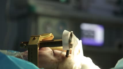 脑部外科手术医疗镜头实拍视频