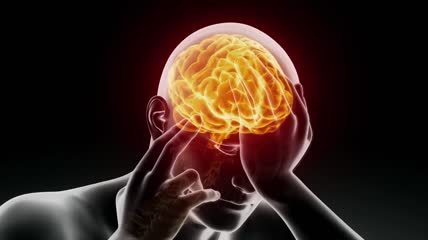 头痛头疼脑痛动画、人体大脑中风脑溢血3d三维动画