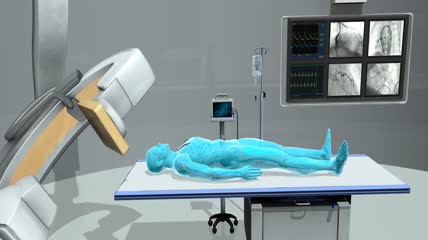 超声心动图三维可视化，导管插入术，染料注射，支架，猪尾导管插入